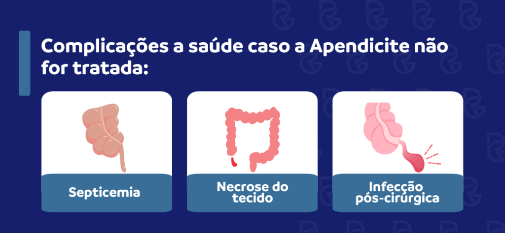 Apendicite aguda