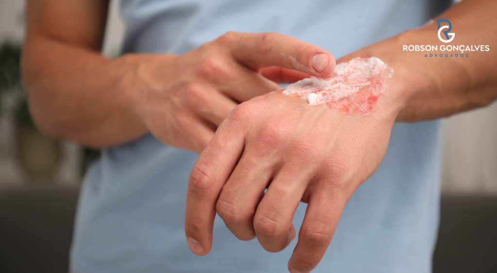 CID Y28 afasta do trabalho