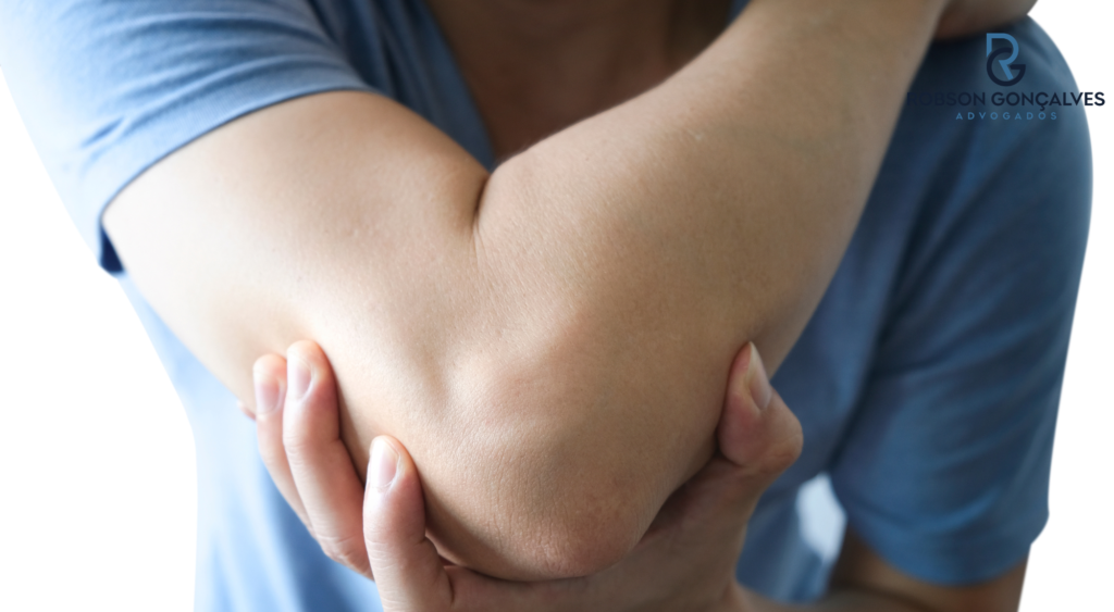 Bursite no cotovelo: sintomas, CID M70.2 e quando pode gerar auxílio-acidente