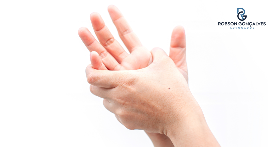 Dedo em gatilho: o que é, sintomas e quando pode gerar direito ao auxílio-acidente