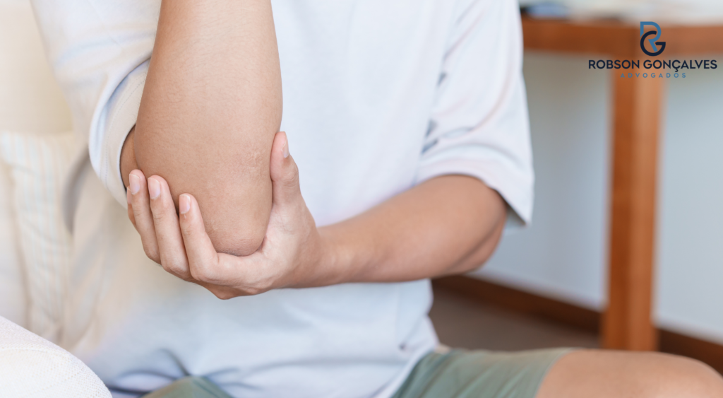 Epicondilite lateral: o que é, sintomas, CID e quando pode dar direito ao auxílio-acidente