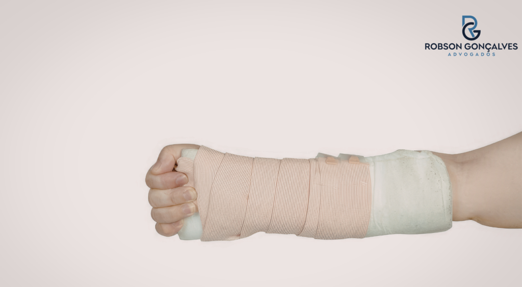 Fratura no Punho Dá Direito a Auxílio-Acidente no INSS?