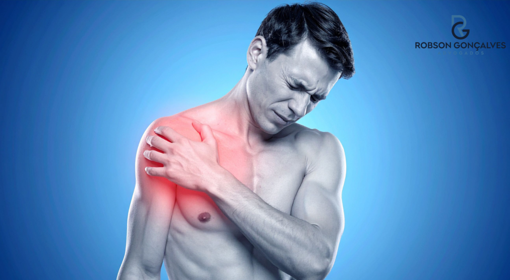 Lesão do Manguito Rotador dá direito a auxílio-acidente?